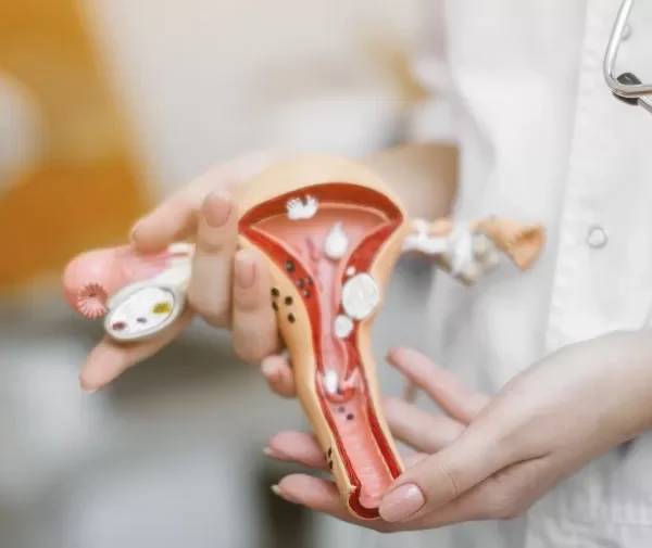 Endometriosis y miomas: avances ofrecen a las mujeres opciones de tratamiento menos invasivas